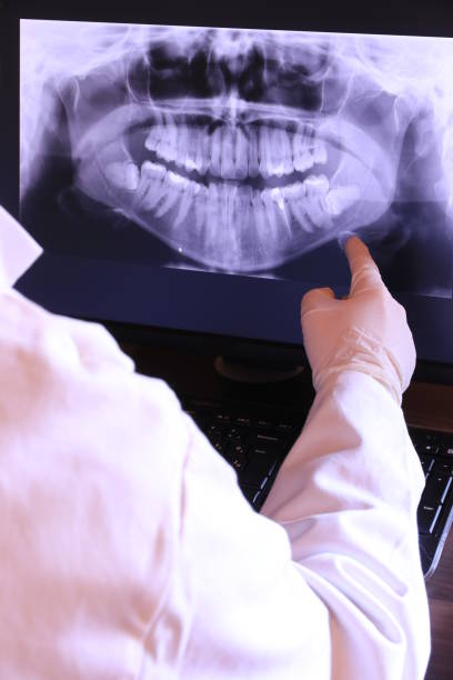 Best Emergency Wisdom Teeth Removal in Washington, IA